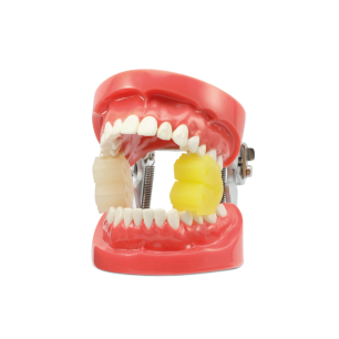Cale Dentaire Adulte Ouverture Buccale — Endodontie | ZTD012