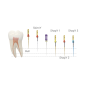 Kit de Retraitement Endodontique NiTi — Désobturation Canalaire Complète | DPE005