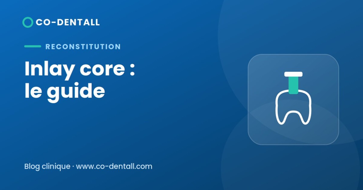 Inlay core : indications, préparation et scellement — le guide clinique