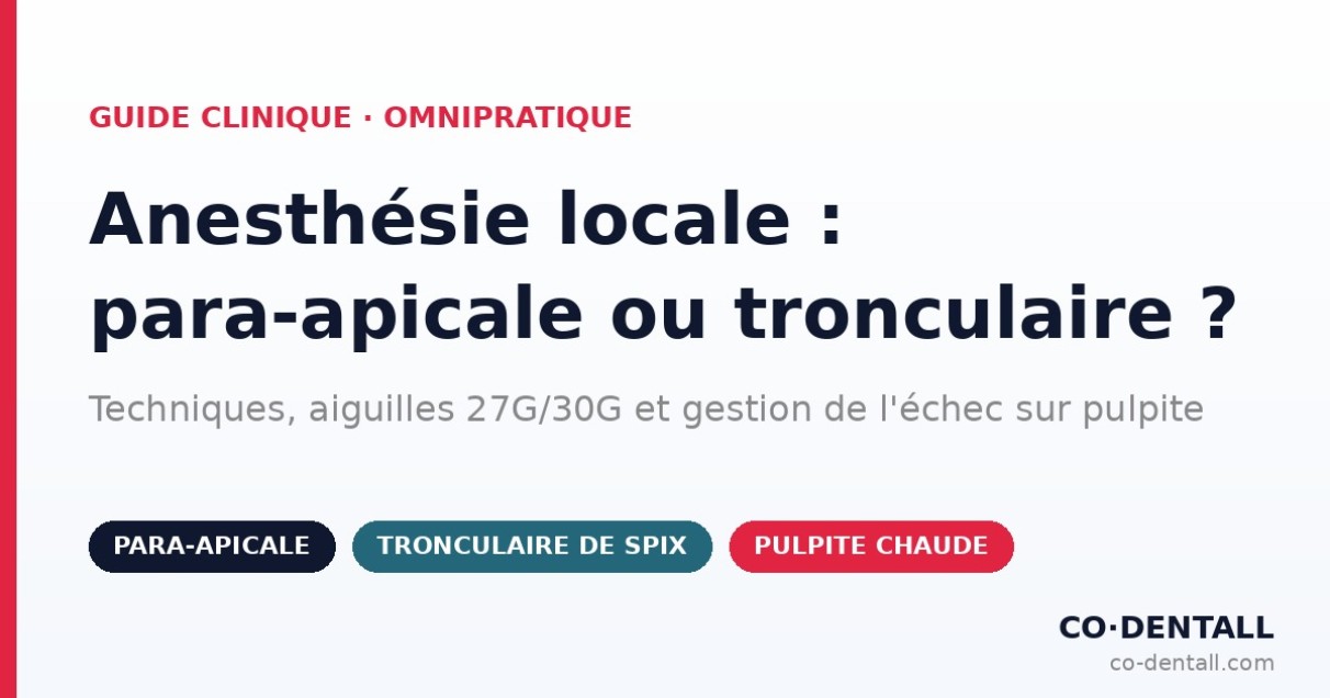 Anesthésie dentaire : para-apicale, tronculaire ou intraligamentaire ? Techniques et matériel