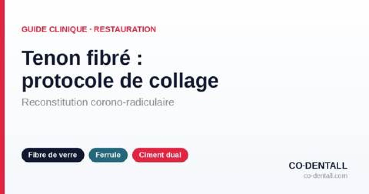 Tenon fibré : protocole de collage intracanalaire pas à pas