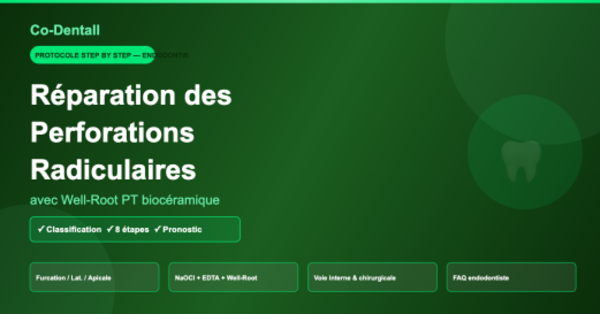 Réparation des perforations radiculaires avec Well-Root PT : protocole step by step