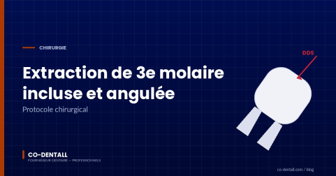 Extraire une 3e molaire incluse et angulée : protocole chirurgical complet