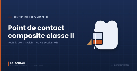 Point de contact composite classe II : la technique sandwich compo flow + composite classique