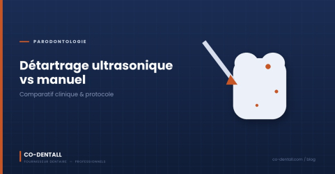 Détartrage ultrasonique vs manuel : quel protocole pour quel cas clinique ?