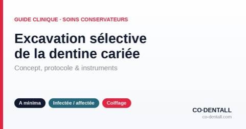 Excavation sélective de la dentine cariée : concept, protocole et instruments
