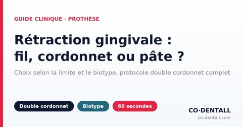 Rétraction gingivale avant empreinte : fil simple, double cordonnet ou pâte ?