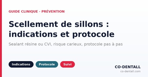 Scellement de sillons : indications, protocole et matériel — le guide du praticien