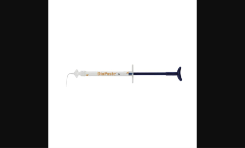 MTA en Endodontie : Composition, Indications et Avantages Cliniques