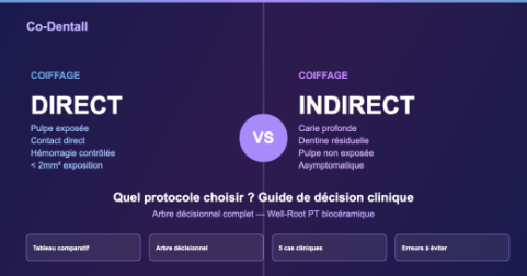Coiffage pulpaire direct vs indirect : comment choisir la bonne technique ?