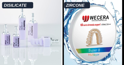 Disilicate de lithium ou zircone : comment choisir selon l'indication